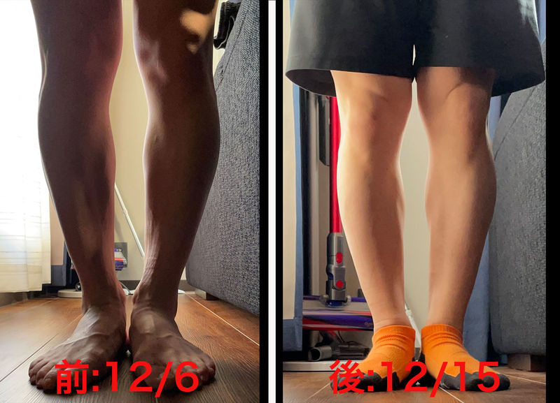 O脚改善-前.jpg